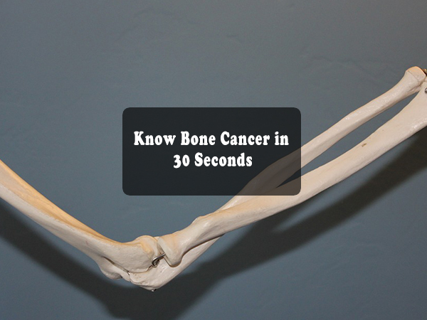 Know Bone Cancer in 30 Seconds